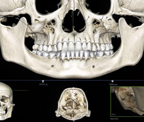 Цефалометрия