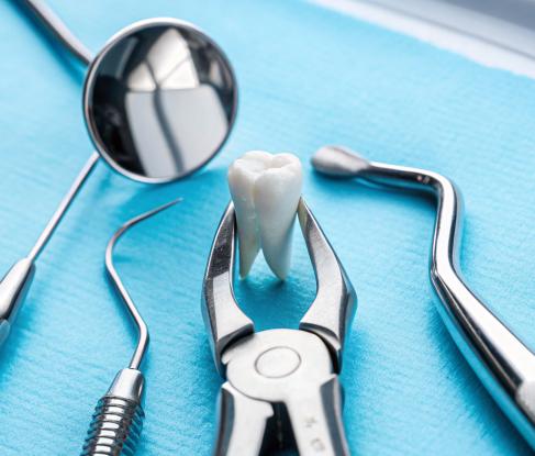 Tooth extraction