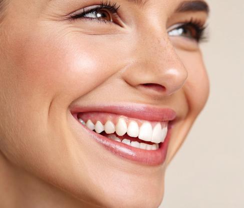 Professional whitening