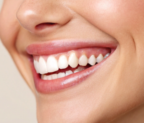 Эстетическая реставрация