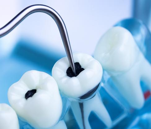 Эндодонтия